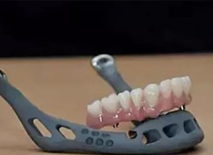 2021年中国3D打印及医用3D打印市场规模预测分析