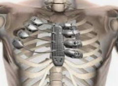 3D可视化在医疗行业的作用 