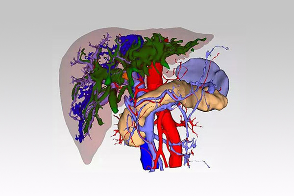 影像数据3D几何重构