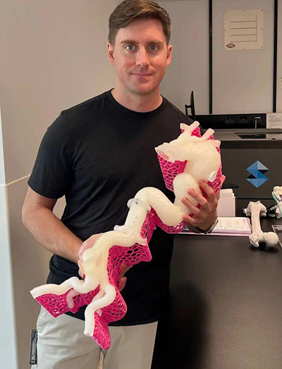 实体模型的力量：查尔斯王子医院的3D打印手术案例