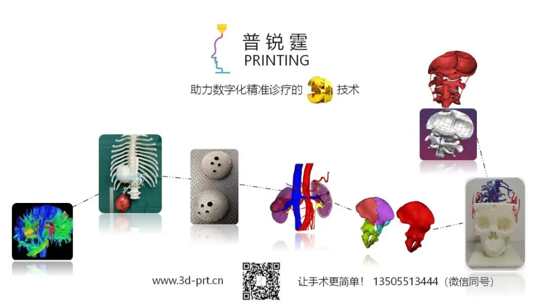 普锐霆 MR脑区AI+数字建模分割技术